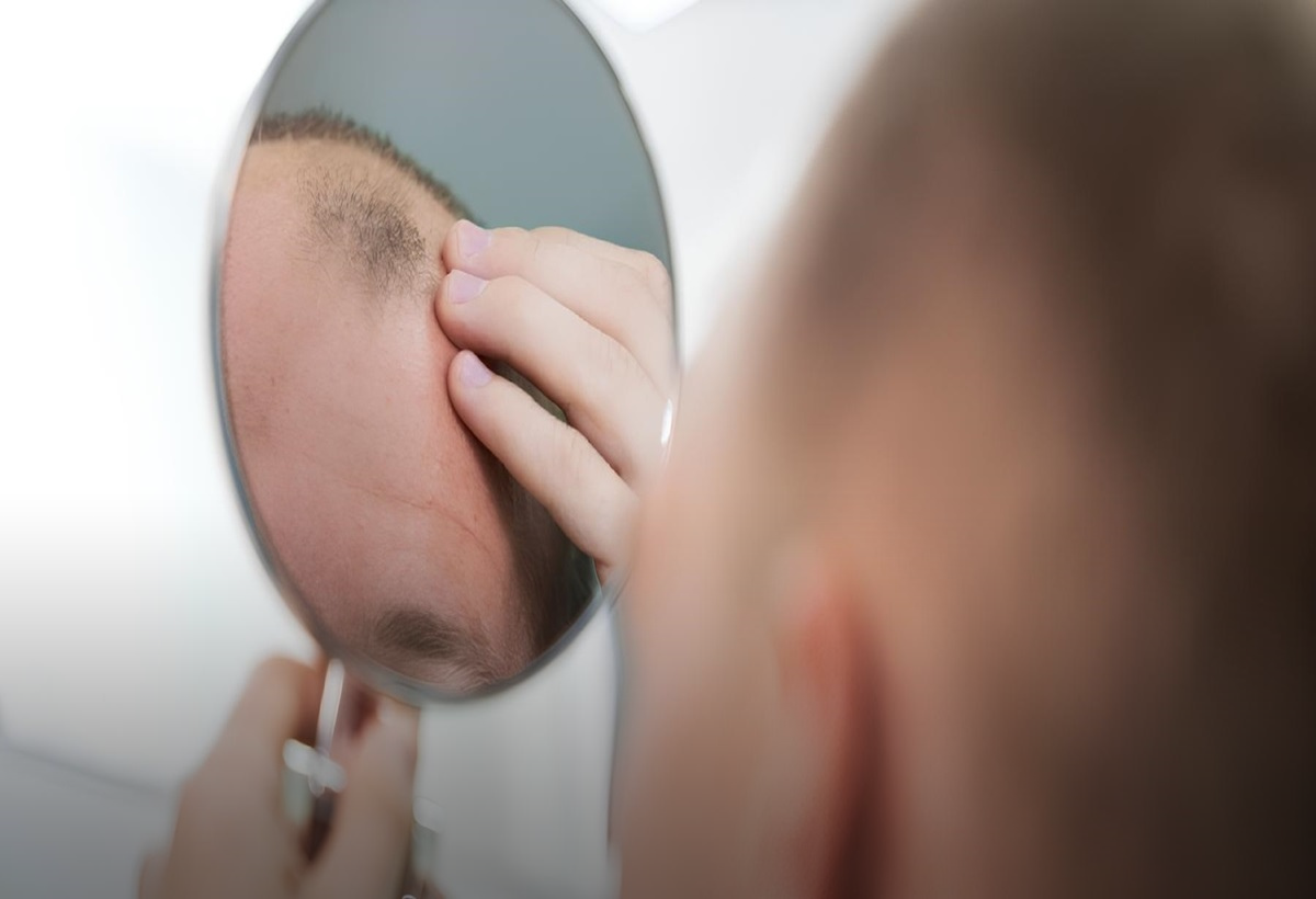Os 3 Principais Problemas para o Cabelo Masculino: Um Guia Completo sobre Saúde Capilar